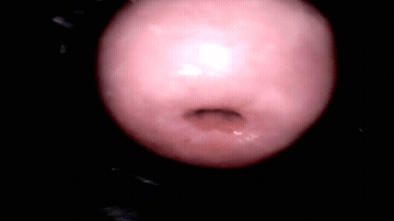 Gyno Sex Toy Toys GIF